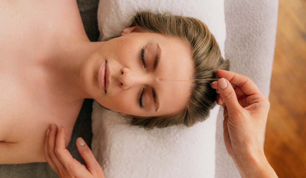 How to Use Acupuncture CPT Codes