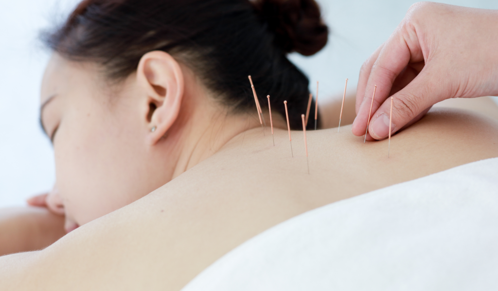 Related CPT Codes for Acupuncture Practices
