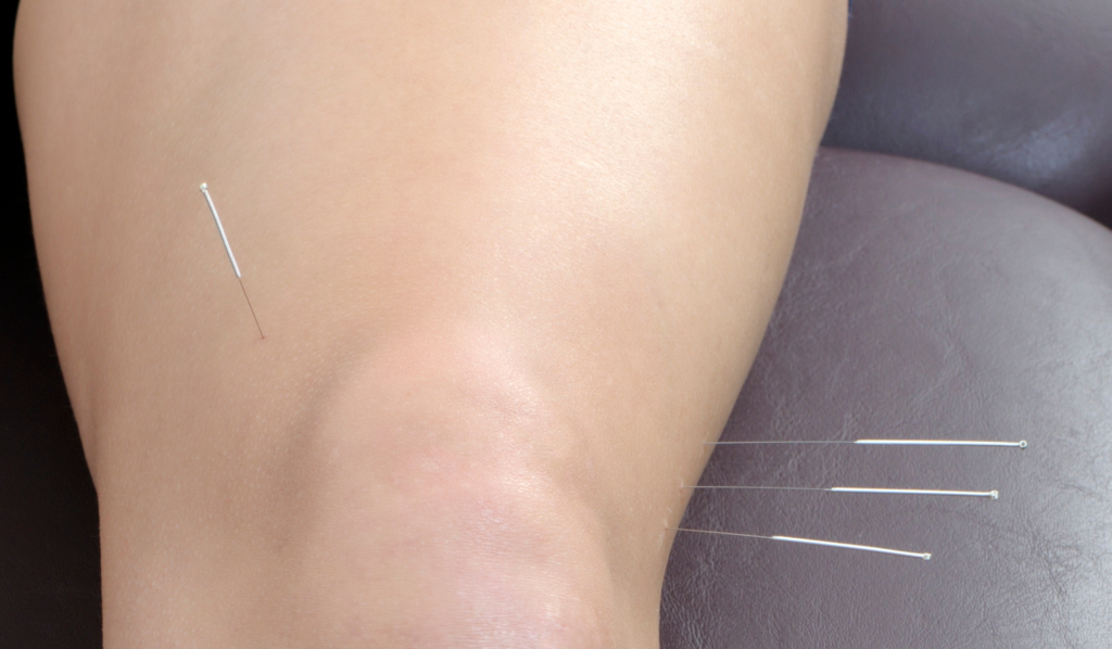 Treatment and Corrective Actions
