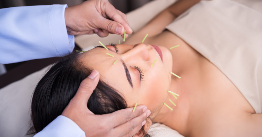 facial-acupuncture-a-natural-approach-to-wrinkle-reduction