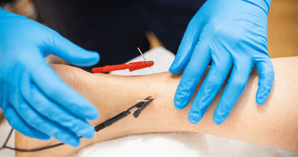 electroacupuncture-for-enhanced-results