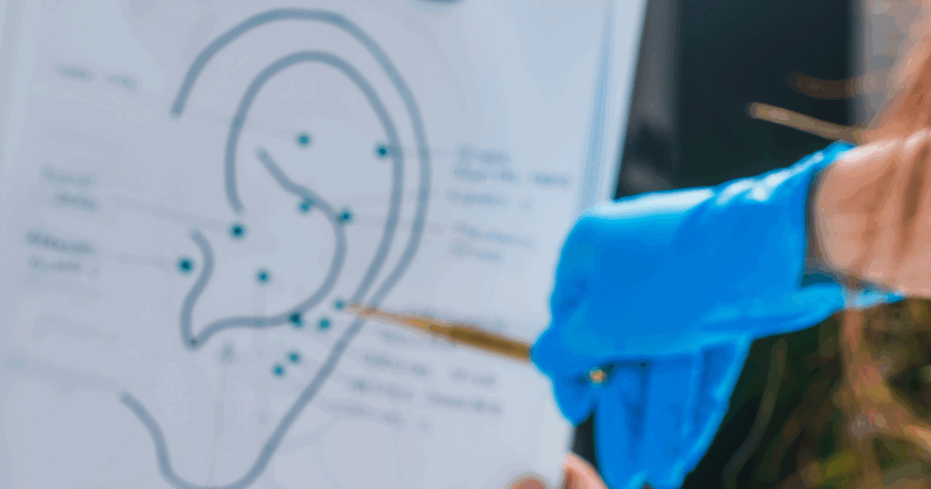 what-to-expect-during-acupuncture-for-tinnitus