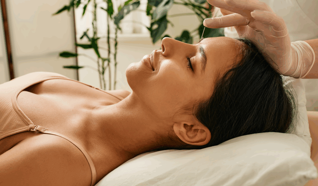 acupuncture needles