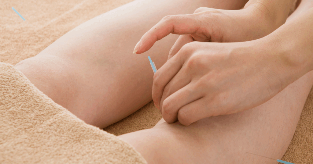 acupuncture-points-and-their-relevance-to-inflammation