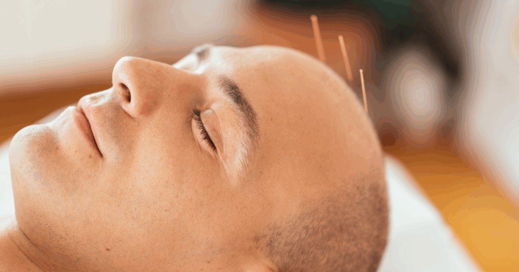 how-acupuncture-works-for-vertigo