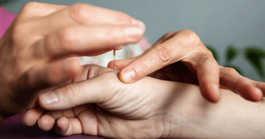 benefits-of-acupuncture-for-different-types-of-neuropathy